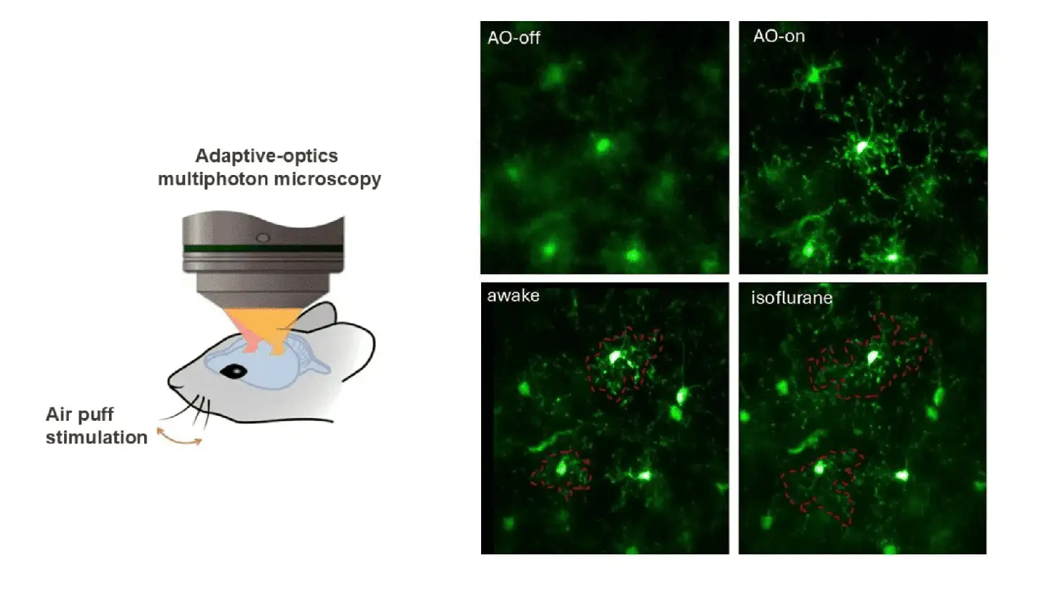 تصویربرداری انقلابی از مغز فعال بدون بیهوشی: پنجره ای به درون ذهن