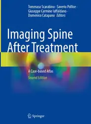 دانلود کتاب Imaging Spine After Treatment: A Case-based Atlas