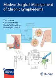 دانلود کتاب Modern Surgical Management of Chronic Lymphedema