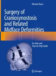 Surgery of Craniosynostosis... image