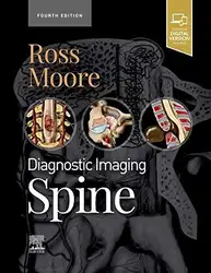 Diagnostic Imaging: Spine image