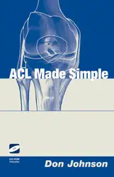 ACL Made Simple image