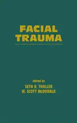 Facial Trauma image
