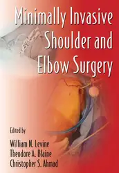 Minimally Invasive Shoulder... image
