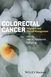 Colorectal Cancer: Diagnosis... image