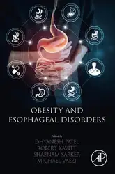 Obesity and Esophageal... image