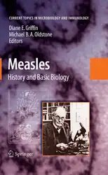 Measles: History and... image