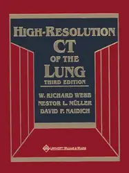 High-Resolution CT of... image