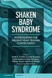 Shaken Baby Syndrome:... image