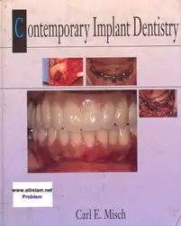 Contemporary Implant Dentistry image