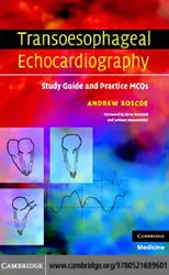 Transoesophageal Echocardiography: Study... image