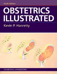 Obstetrics Illustrated image