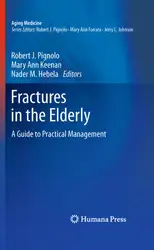 Fractures in the... image
