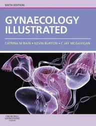 Gynaecology illustrated image