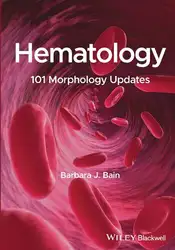 Hematology: ۱۰۱ Morphology... image