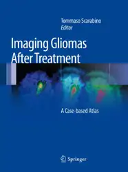 Imaging Gliomas After... image