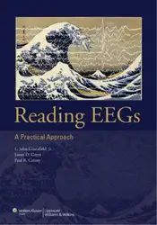 Reading EEGs: A... image