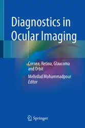 Download Diagnostics in Ocular Imaging: Cornea, Retina, Glaucoma and Orbit