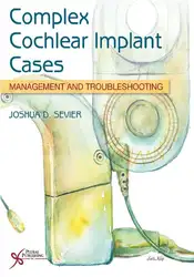 Complex Cochlear Implant... image