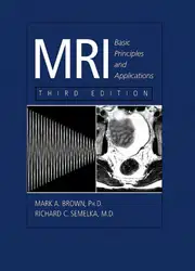 MRI: basic principles... image