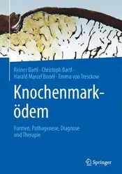 Knochenmarködem: Formen, Pathogenese,... image