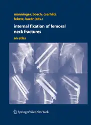 Internal fixation of... image