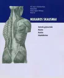 Nugaros skausmai: natūralūs... image