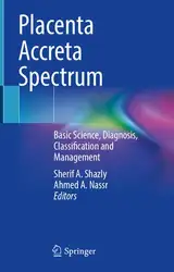 Placenta Accreta Spectrum:... image