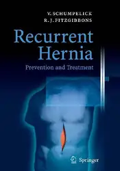 Recurrent Hernia: Prevention... image