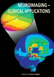 Neuroimaging - Clinical... image