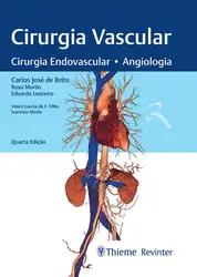 Cirurgia Vascular: Cirurgia... image