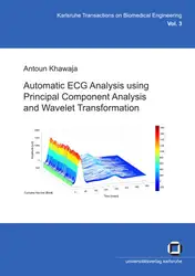 Automatic ECG Analysis... image
