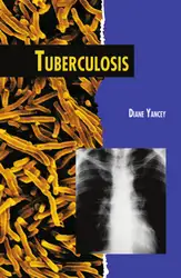 Tuberculosis (Twenty-First Century... image