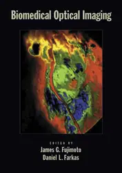 Biomedical optical imaging image