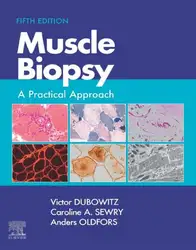 Muscle Biopsy: A... image