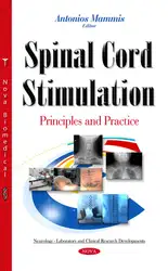 Spinal Cord Stimulation image