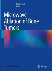 Microwave Ablation of... image