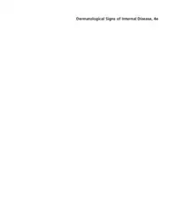 Dermatological Signs of... image