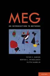 MEG: An Introduction... image