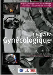Syllabus Imagerie Gynécologique image