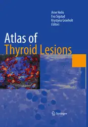 Atlas of thyroid... image