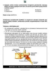 ۲۰۱۷ Eylül Yaz... image