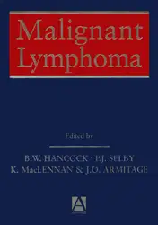 Malignant Lymphoma image