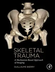 Skeletal Trauma: A... image