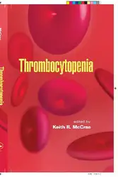 Thrombocytopenia image