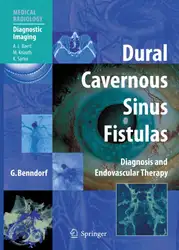 Dural Cavernous Sinus... image