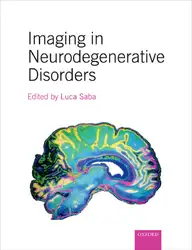 Imaging in Neurodegenerative... image