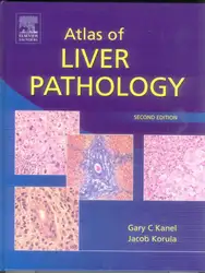 Atlas of Liver... image