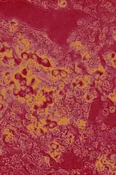 Tumor Suppressor Genes:... image