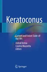 Keratoconus: Current and... image